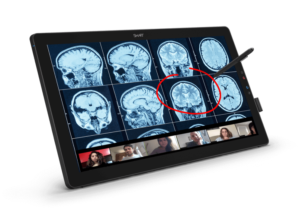 A SMART Podium interactive display showing a medical MRI brain scan being annotated with a digital ink, with video conferencing participants in a sidebar, illustrating a dynamic and interactive remote presentation setup.
